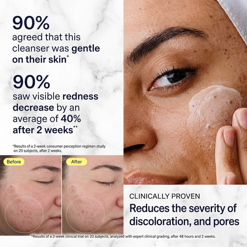 Skinfix Acne+ 2% BHA Cleanser – 5 oz